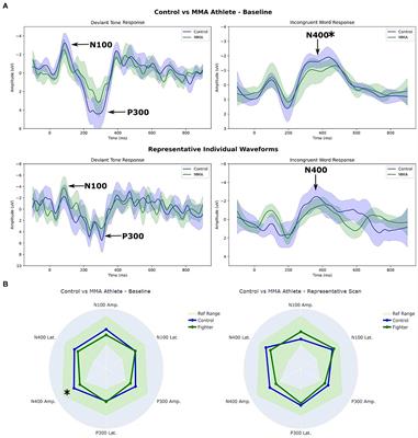 Mixed martial art athletes demonstrate different brain vital sign profiles compared to matched controls at baseline